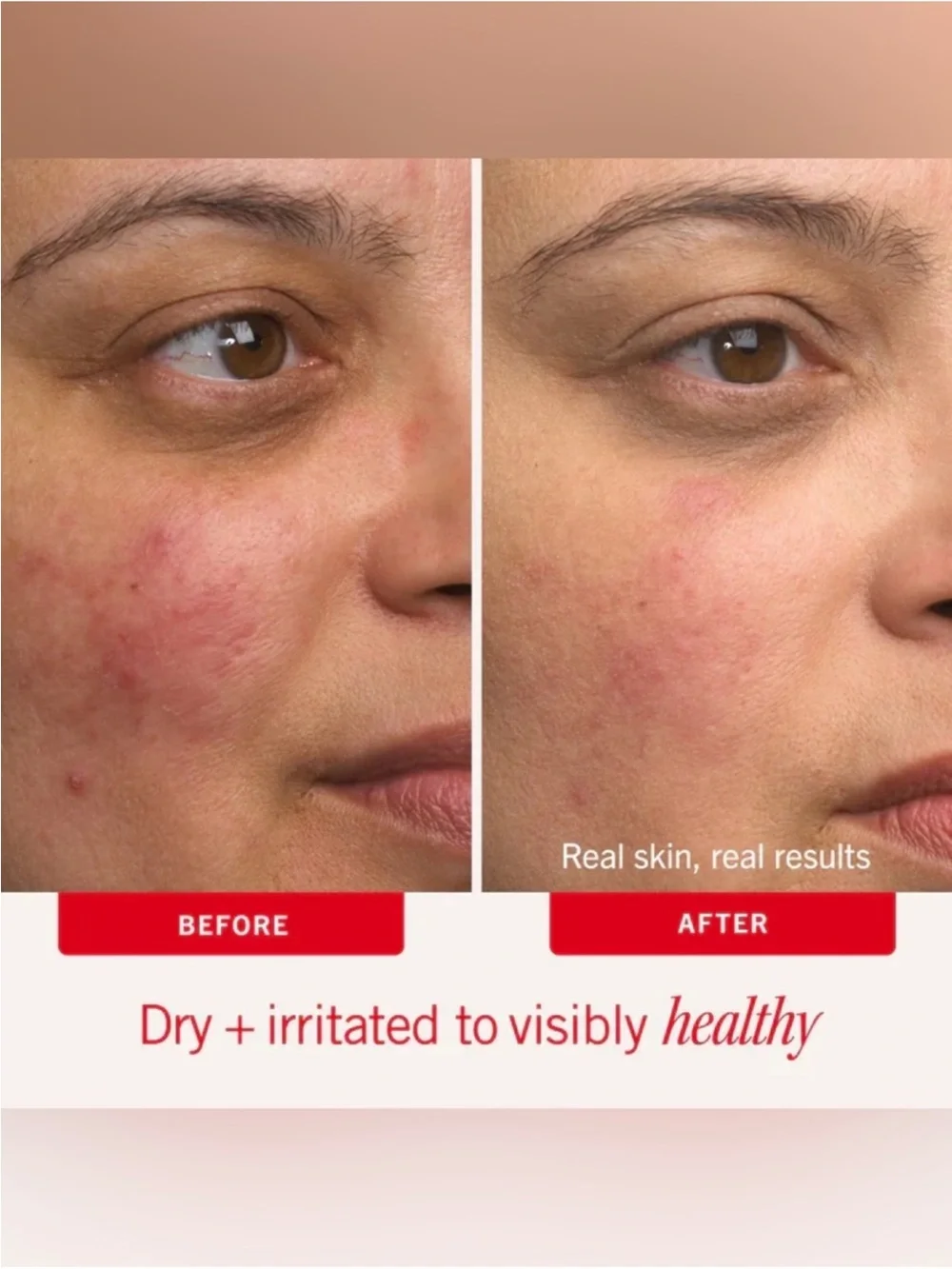 First Aid Beauty Ultra Repair Cream - Intense Hydration - Skin Protectant